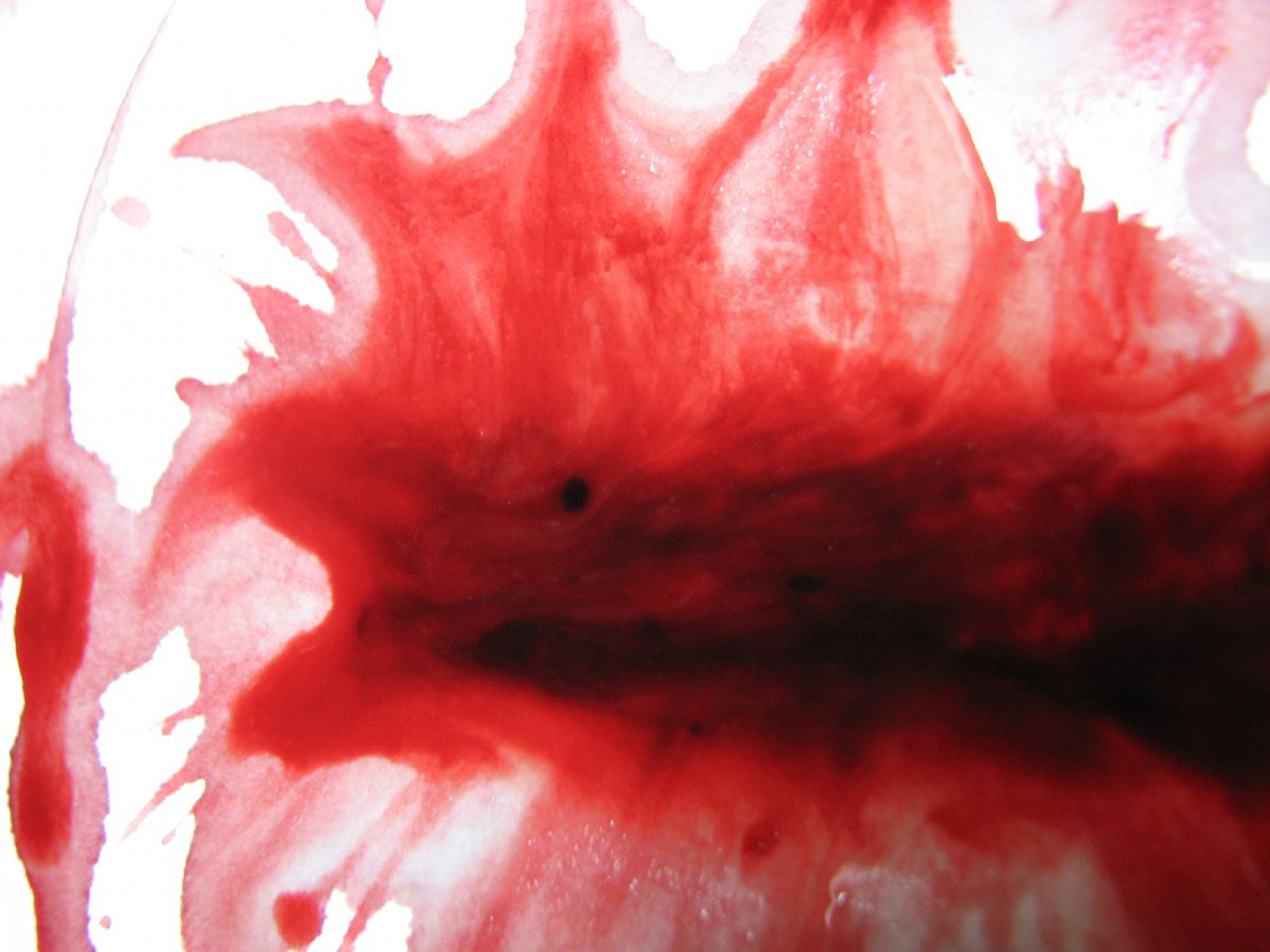 Dream Meaning of Menstruation Bleeding